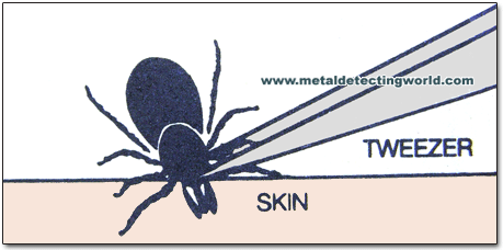 Detaching the Deer Tick